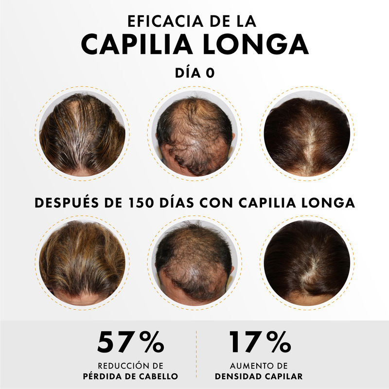 KIT ACTIVADOR DE CRECIMIENTO + SHAMPOoo DE CEBOLLA FORTALECEDORa